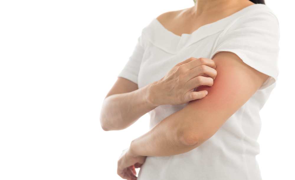 9 Common Psoriasis Triggers To Avoid Keep Asking